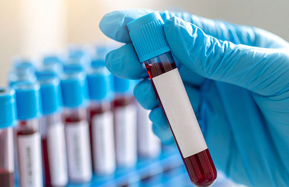 Private Hospital fined Rs. 500,000 for overcharging on blood tests