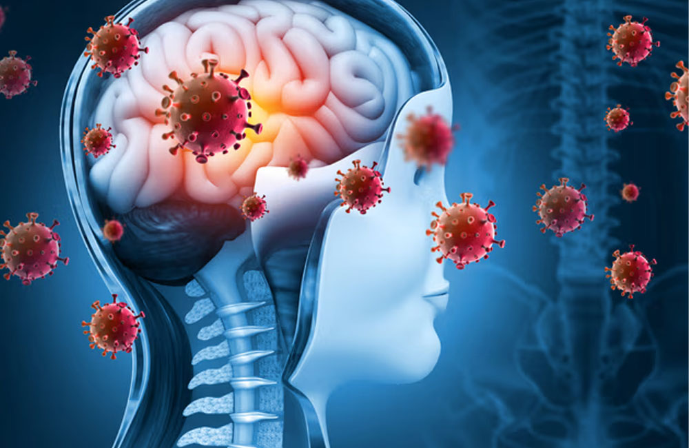 237 suspected meningitis cases reported across Sri Lanka