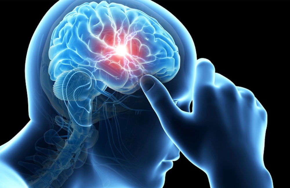 Say Goodbye to Migraines: 5 Daily Habits That Work