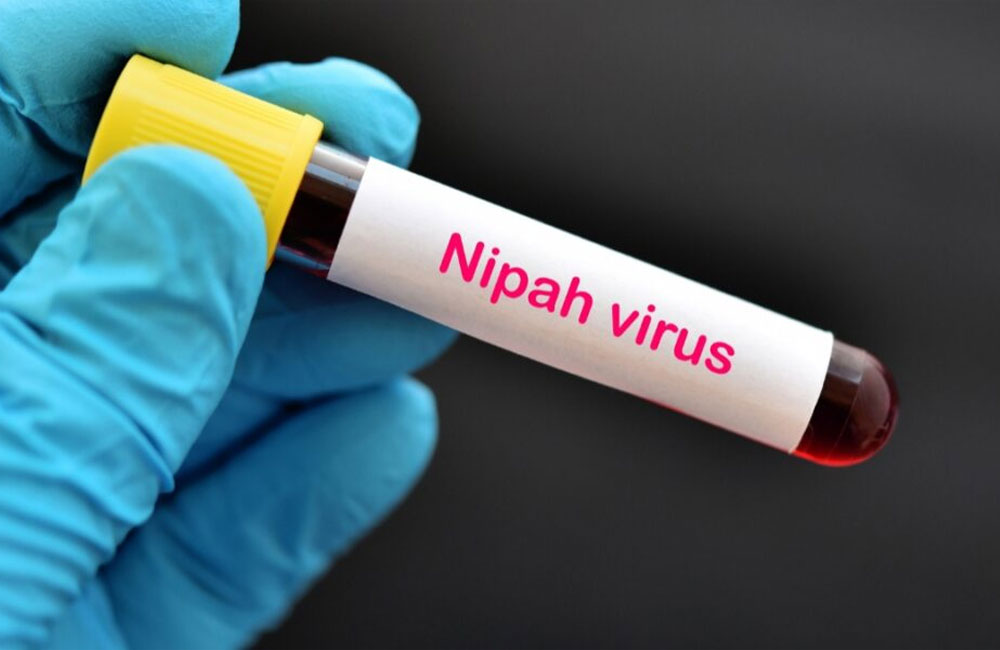 Sri Lanka on Alert as Nipah Virus Cases Emerge in India